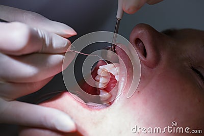 Patient at dental hygienists office Stock Photo