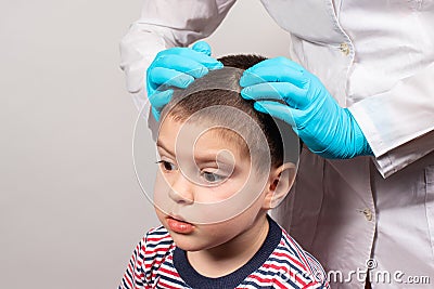 The pediatrician in the gloves will check the presence of lice and nits in a small child. Pediculosis in kindergarten, preventive Stock Photo