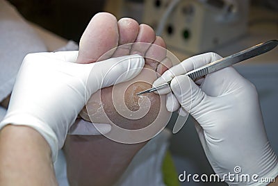 Pedicure removing hard skin. Stock Photo