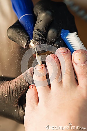 Pedicure removing old coating. Chiropody Stock Photo