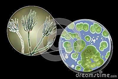 Penicillium mold fungi, illustration and photo of colony grown on nutrient medium Cartoon Illustration
