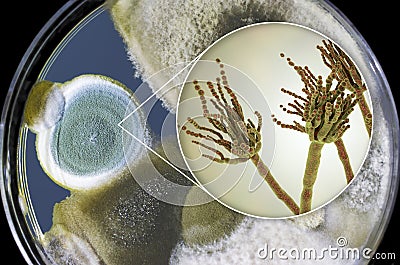 Penicillium mold fungi, illustration and photo of colony grown on nutrient medium Cartoon Illustration