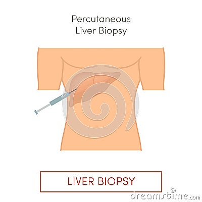 Percutaneous liver biopsy Cartoon Illustration