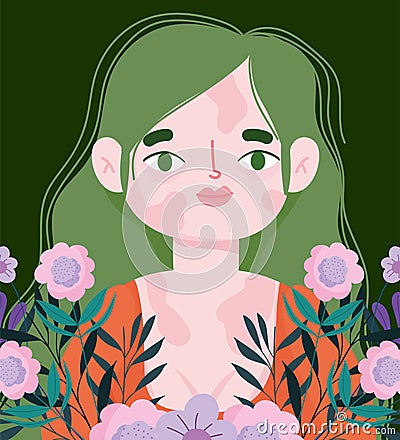 Perfectly imperfect, young woman with vitiligo on their face and body, flowers floral decoration Vector Illustration