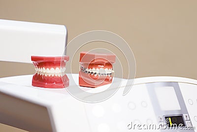 Perfectly straight teeth. Jaw model, close up. Stock Photo