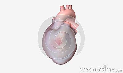 Pericardial effusion is a cardiac condition characterized by fluid buildup outside the heart Stock Photo