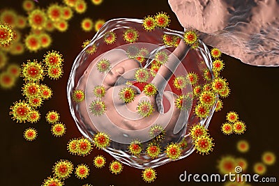 Perinatal transmission of HIV infection, conceptual image Cartoon Illustration