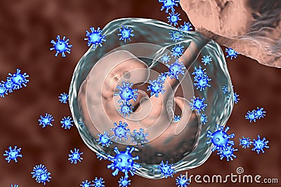 Perinatal transmission of infection, conceptual image Cartoon Illustration