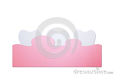 Periodontitis or gum disease with swell - swollen on gum and tooth because inflammation, dental problem Stock Photo