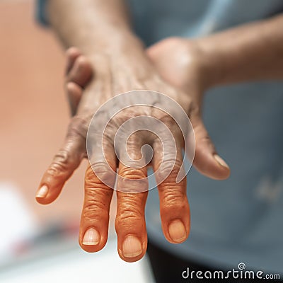 Peripheral Neuropathy pain in elderly patient on hand, palm, fingers and sensory nerves with numb, aching, muscle weakness Stock Photo