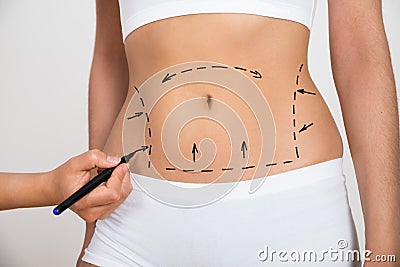 Person hand drawing lines on a woman's abdomen Stock Photo