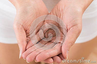 Person hand with loss hair Stock Photo