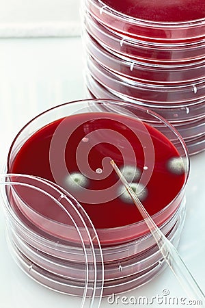 Petri dish with dropper Stock Photo