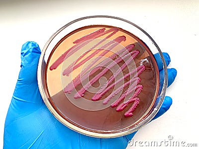 Petri dish with enterobacteria. Bacteria colonies culture on selective agar media Stock Photo