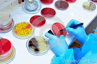 Petri dish. Microbiological laboratory Stock Photo