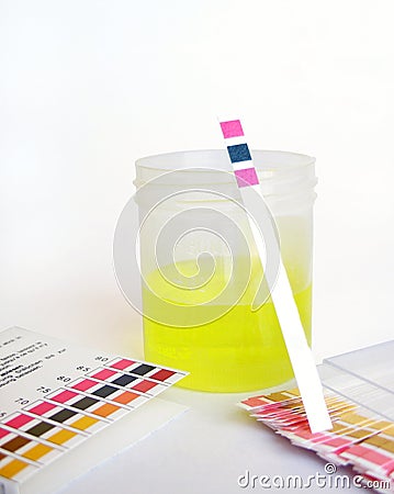 PH analysis of specimen Stock Photo