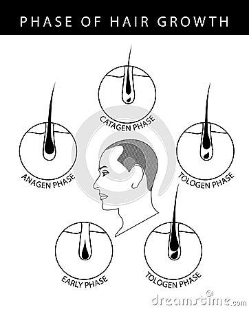 Phase of human hair growth cycle catagen, telogen, early, anagen phase, illustration on white background Cartoon Illustration