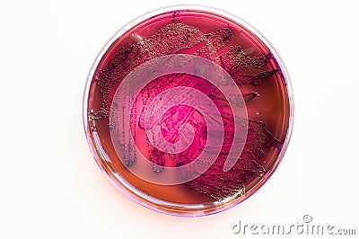 phenotypic traits of Escherichia coli bacteria on selective media Stock Photo