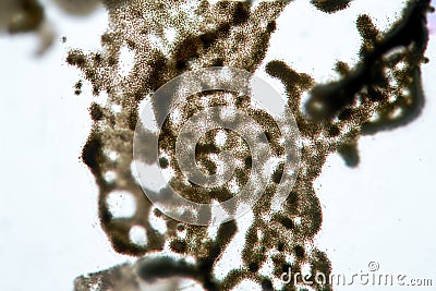 Unicellular algae Microcystis cyanobacteria by microscope. Cause of freshwater algal pollution Stock Photo