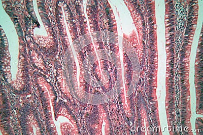 Photo of large intestine cells. Stock Photo