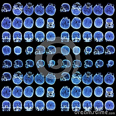 Photo of medical tomography. Background Stock Photo