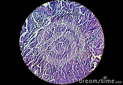 A histological slide of a tissue sample. Close microscopic view Stock Photo