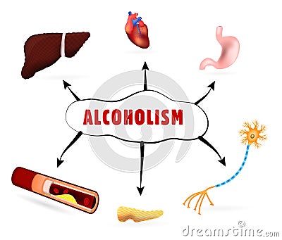 Physical effects of alcoholism Vector Illustration