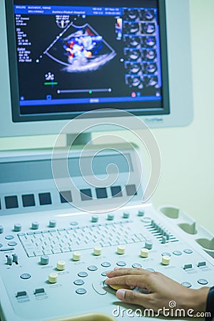 Echocardiography ultrasound machine. Stock Photo