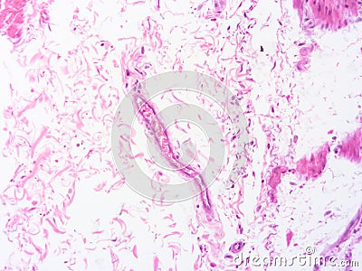 picture of histology human tissue with microscope from laboratory (not Illustration Designation) Stock Photo