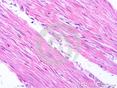 picture of histology human tissue with microscope from laboratory (not Illustration Designation) Stock Photo