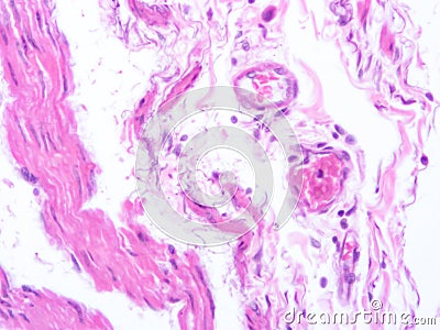 picture of histology human tissue with microscope from laboratory (not Illustration Designation) Stock Photo