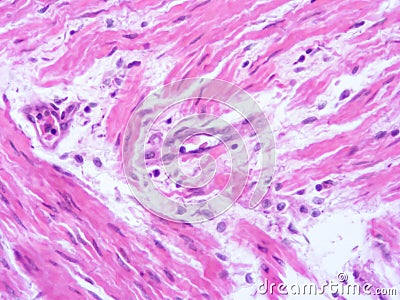 picture of histology human tissue with microscope from laboratory (not Illustration Designation) Stock Photo