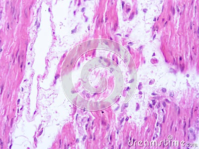 picture of histology human tissue with microscope from laboratory (not Illustration Designation) Stock Photo