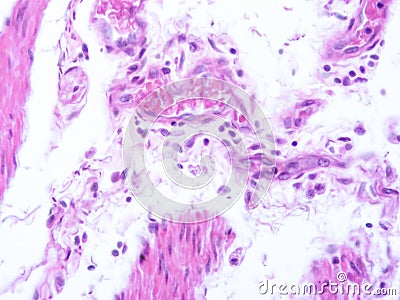 picture of histology human tissue with microscope from laboratory (not Illustration Designation) Stock Photo