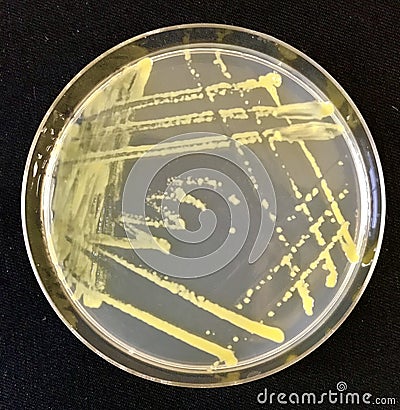 Xanthomonas on agar media Stock Photo