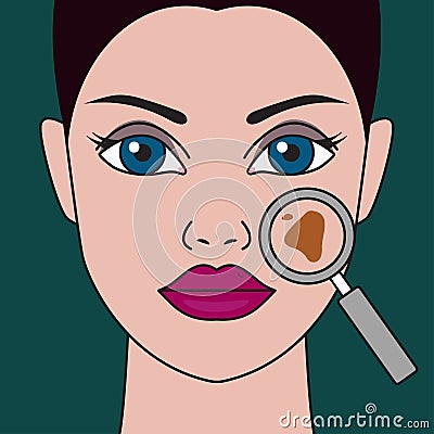 Pigment spot Vector Illustration