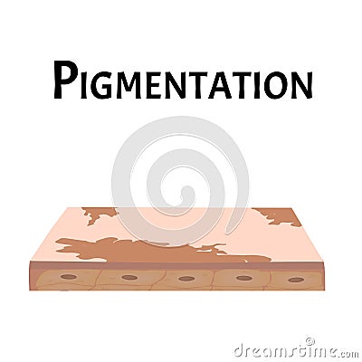 Pigmentation on the skin. A pigmented spot on the skin of the face. Vector illustration Vector Illustration