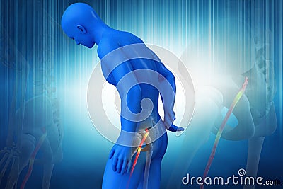 Pinched human sciatic nerve, anatomical vision. 3d illustration Cartoon Illustration