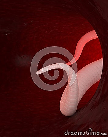 A pink Helminth in the intestines, 3d Illustration Stock Photo