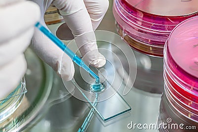 Pipette and the specimen Stock Photo