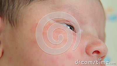 Allergie Au Soleil Sur Le Visage Du Bebe Taches Rouges Sous Les Yeux De L Enfant La Mere A Touche Son Visage L Enfant Est Triste Clips Videos Video Du Oriente Enfant