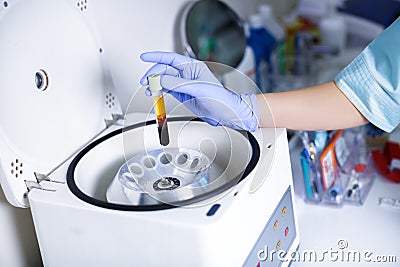 Plasmolifting. Preparation of blood for injections. cosmetologist puts tube of blood in centrifuge Stock Photo