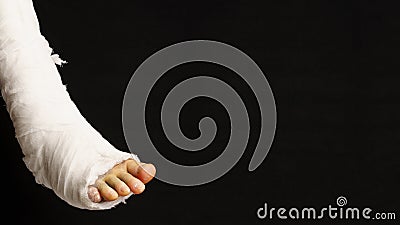 Plaster cast on the leg. man broke his leg and has a plastered foot on black background Stock Photo