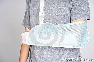 Plastered arm, broken arms at teenagers on a white background Stock Photo