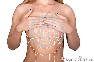 Plastic or cosmetic surgery, cellulite correction, people and bodycare concept. female bust with lines. breast Stock Photo