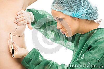 Plastic surgeon woman drawing on body Stock Photo