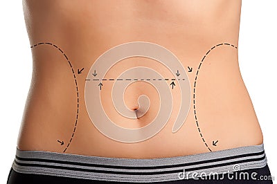 Plastic Surgery Stock Photo