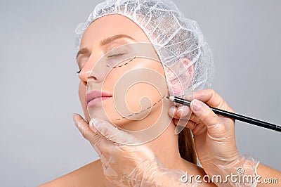 Plastic surgery. Doctor drawing perforation lines on woman`s face Stock Photo