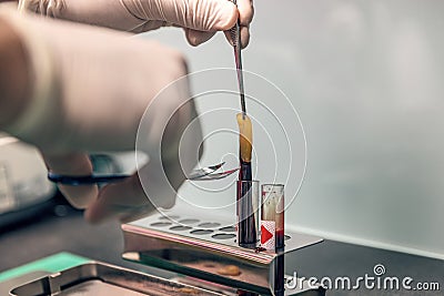 Platelet-rich fibrin application Stock Photo