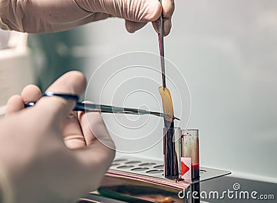 Platelet Rich Fibrin Stock Photo